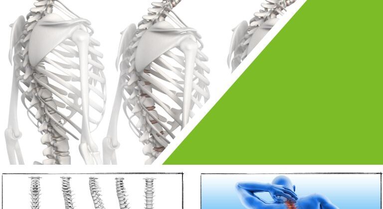 De connectie tussen slechte houding en pijnklachten, en hoe houdingstherapie kan helpen